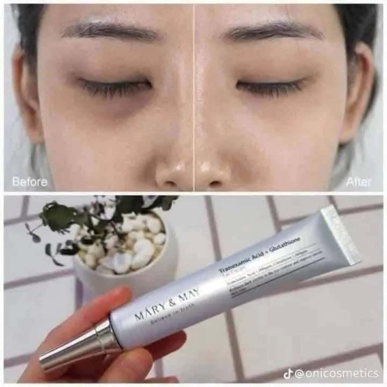 WhatsApp Image 2025-10-12 at 15.56.25 كريم تفتيح الهالات السوداء – نتيجة خلال أسبوعين فقط - الصورة 1